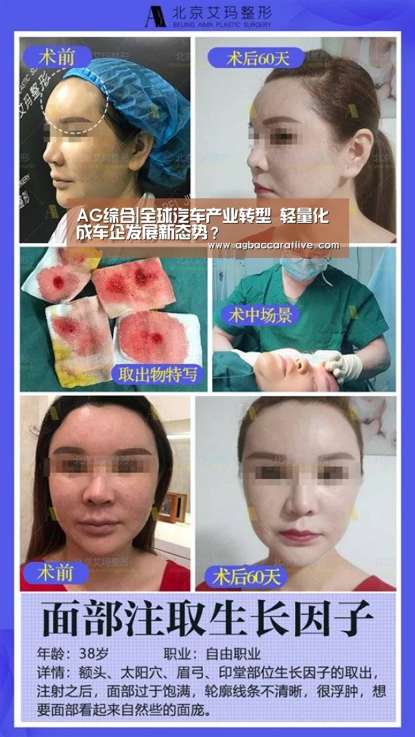 AG直达